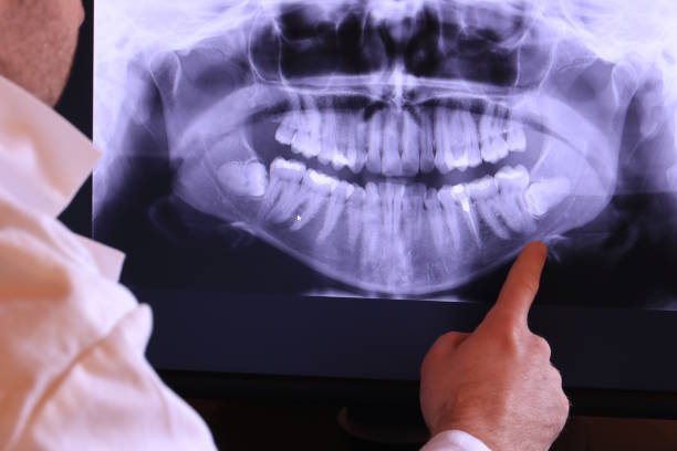 Best Emergency Care for Gum Disease in Eufaula, OK